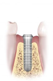 Illustration 1 Illustration 1